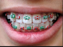 orthodontic treatment